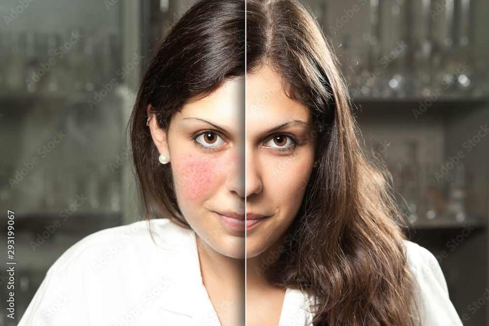A before and after portrait of a professional woman who suffered from