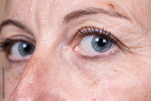 Schilderij op canvas A closeup and off to the side view on the blue eyes of a mature lady, showing crow's feet, sun spots and imperfections in the skin, natural aging of the human body