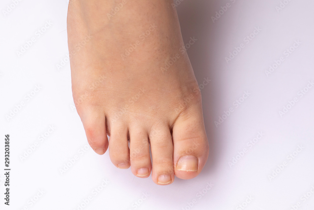 An extreme closeup and top view on the naked foot of a caucasian person, isolated against a clean white background, details of the toes and toe nails. An extreme closeup and top view on the naked foot of a caucasian person, isolated against a clean white background, details of the toes and toe nails.