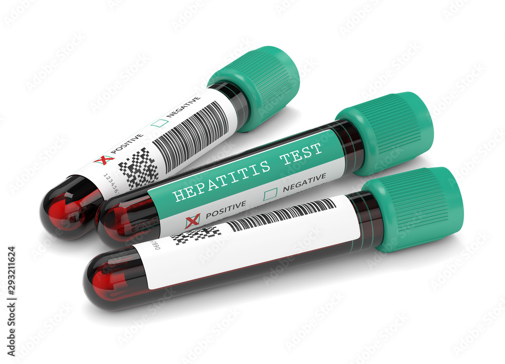 3d render of  blood samples with hepatitis test - obrazy, fototapety, plakaty 