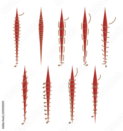 Illustration Set With Different Surgical Stitches Isolated On White Background
