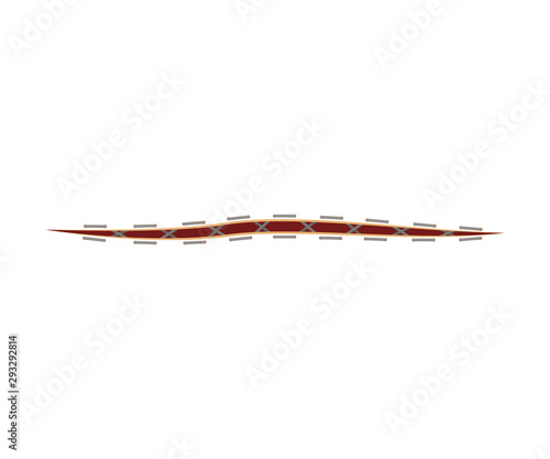 Vector Illustration Of Medical Suture Or Stitch For Wound