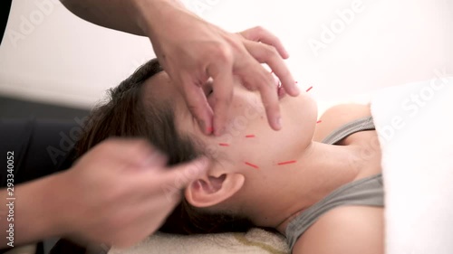 顔に針を刺しリフトアップの施術を受ける若い女性