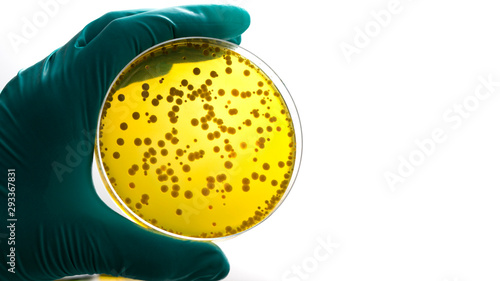 Gloved hand holding a Petri dish Bacteria culture