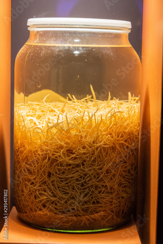 Jar containing the parasites from one kangaroo’s stomach. photo