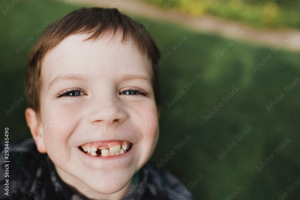 Portrait of a boy with freckles and crooked teeth Portrait of a boy with freckles and crooked teeth