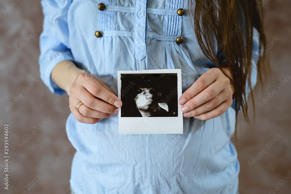 Pregnant woman shows the picture from the ultrasound. Pregnant woman shows the picture from the ultrasound.