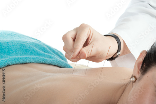 young woman on acupuncture treatment © tankist276