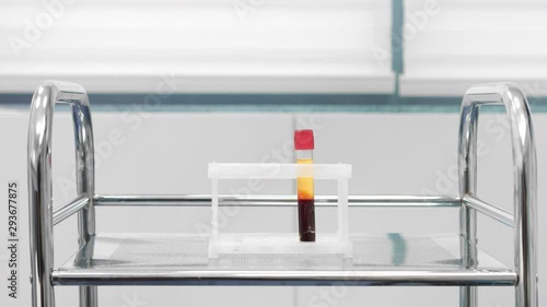 Vacuum blood sample tube with centrifuged blood sample.