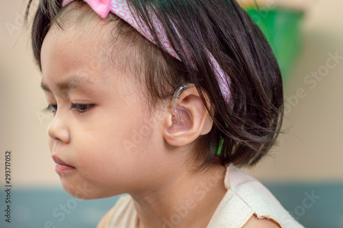 Asian child girl hearing impaired wear hearing aids.