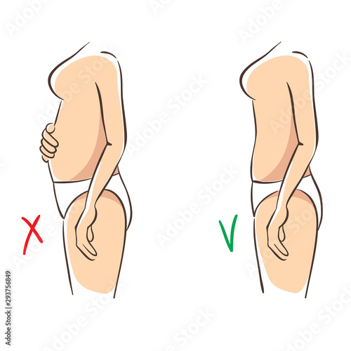 Abdominal distention. Female body before and after the diet or or taking medication, vector illustration.
