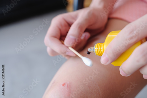 Woman hand hold Antiseptic (Butadine) and dropping on cotton wool for dress wound at knee caused by accident, Scratches from fall.