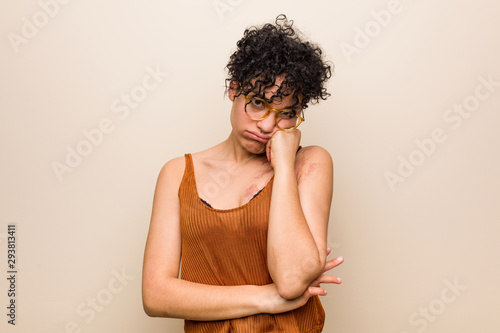 Young african american woman with skin birth mark who feels sad and pensive, looking at copy space.