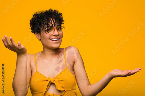 Young african american woman with skin birth mark doubting between two options.