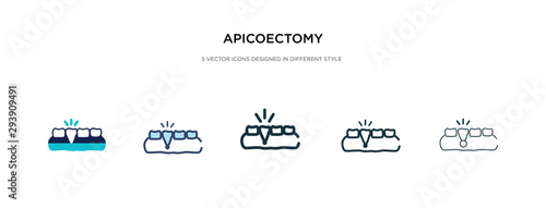 apicoectomy icon in different style vector illustration. two colored and black apicoectomy vector icons designed in filled, outline, line and stroke style can be used for web, mobile, ui