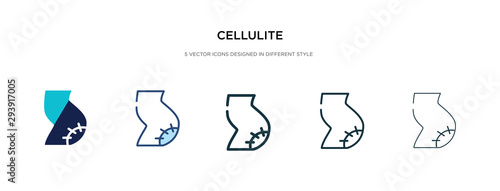 cellulite icon in different style vector illustration. two colored and black cellulite vector icons designed in filled, outline, line and stroke style can be used for web, mobile, ui