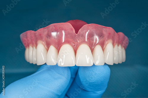 denture. Full removable denture of the upper jaw of a man with white beautiful teeth in the hand of a dentist. Aesthetic Dentistry photo