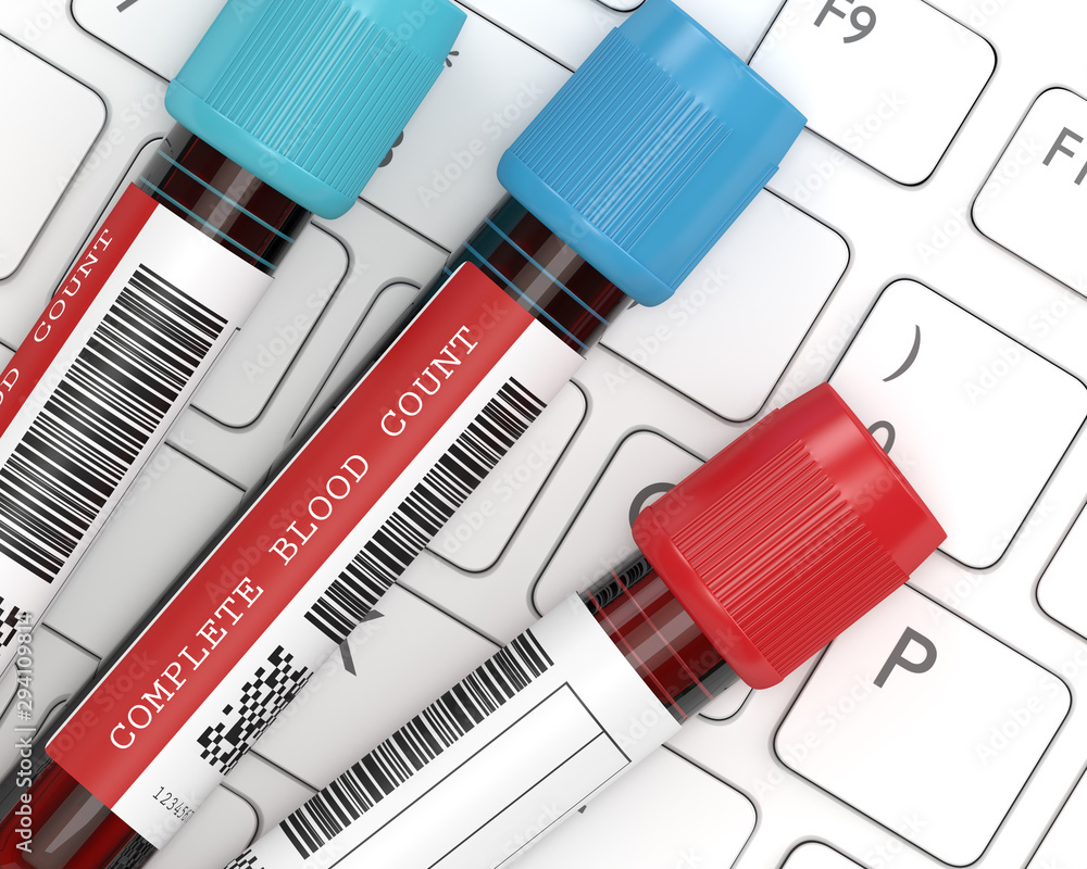 3d render of CBC blood tubes on keyboard 3d render of CBC blood tubes on keyboard