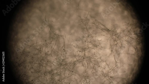 Botrytis cinerea hypae seen through an optical microscope in a microbiology labo