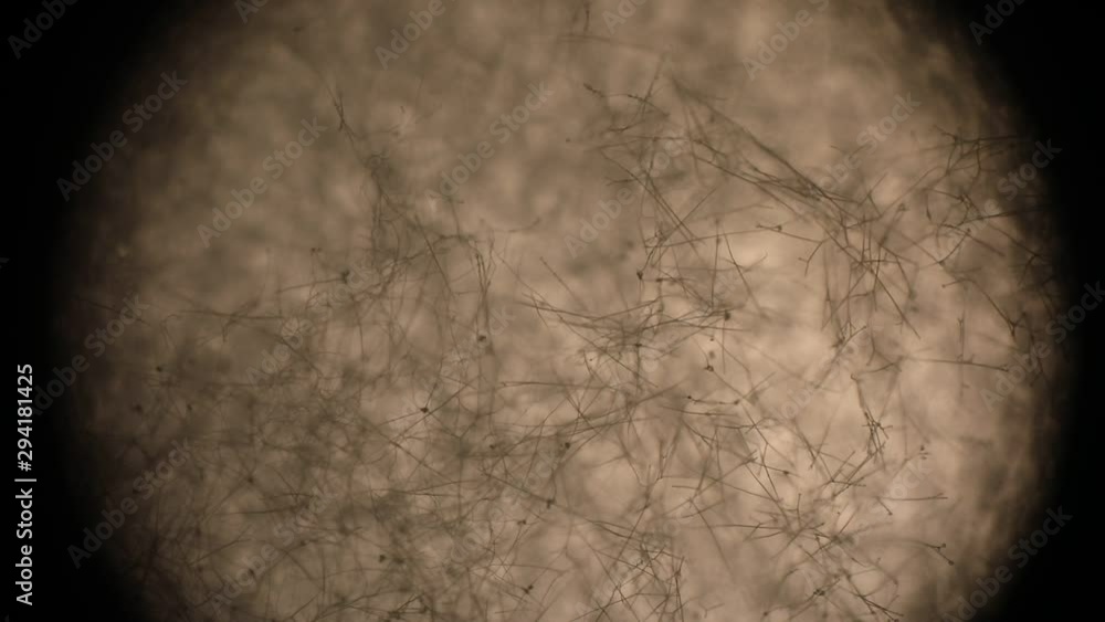 Botrytis cinerea hyphae seen under a microscope during a ...