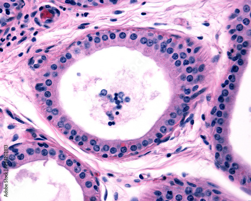 Apocrine sweat gland. Secretory units photo