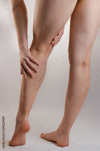 Fototapeta Naklejka Na Ścianę i Meble -  Medicine and health. The concept of female varicose veins. A woman rubs her tired legs with vascular stars. Back view. Vertical orientation