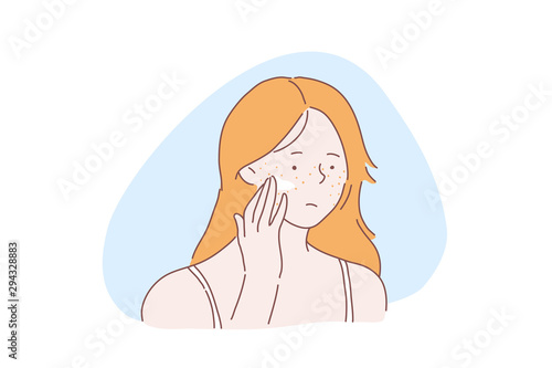 Teenage girl skincare problem concept. Woman with facial rash, lady applies cream, ointment on skin with acne pimples, covers freckles with foundation base, concealer. Simple flat vector