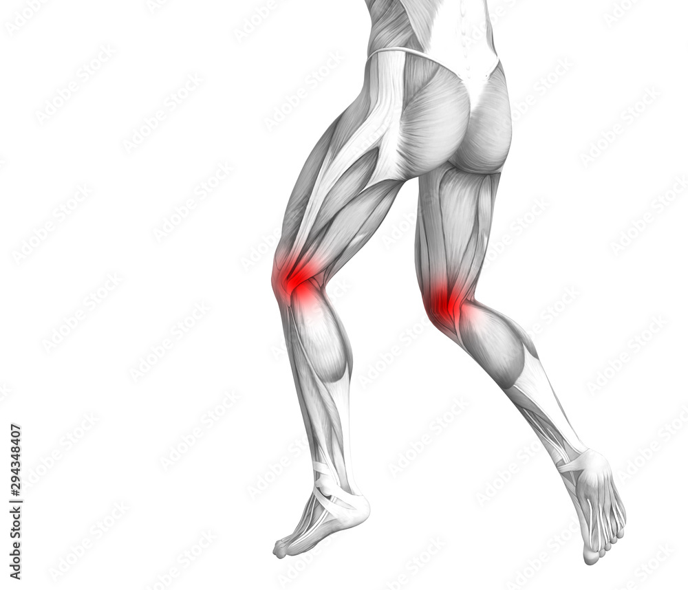 Conceptual knee human anatomy with red hot spot inflammation or articular joint pain for leg health care therapy or sport muscle concepts. 3D illustration man arthritis or bone osteoporosis disease Conceptual knee human anatomy with red hot spot inflammation or articular joint pain for leg health care therapy or sport muscle concepts. 3D illustration man arthritis or bone osteoporosis disease