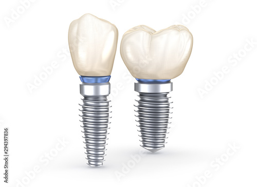 Dental Implants. 3D illustration concept of human teeth