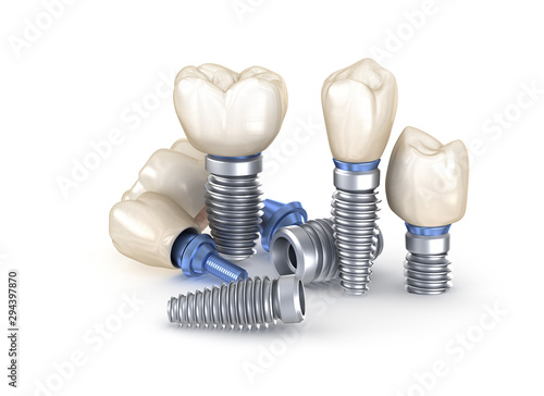 Dental Implants. 3D illustration concept of human teeth