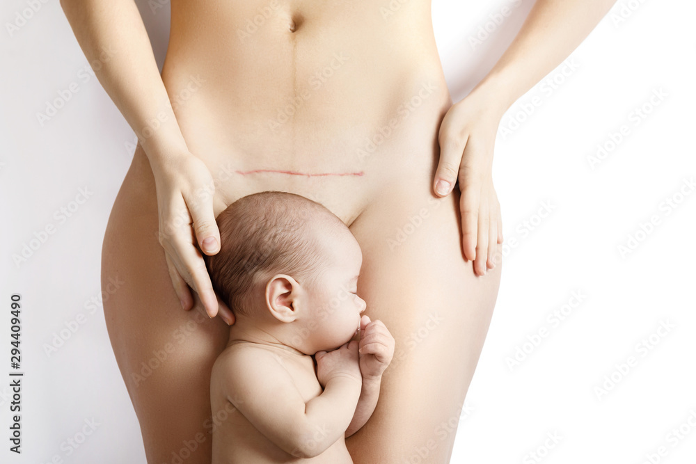 Newborn baby and his mother with a scar after C-Section on her belly - obrazy, fototapety, plakaty 