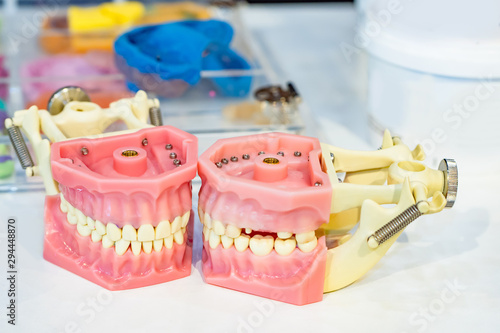 Orthodontist. The model of the jaw. Visual aid for training a dentist. Career of an orthadantist. Removable denture on the table. Workplace of a stamotologist. The desktop of a dental technician.
