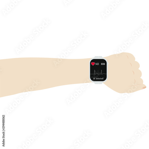 Smartwatch Atrial Fibrillation