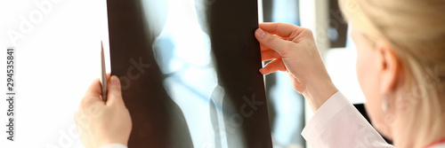 Canvas Print Female radiolog holding in hands x-ray films images aganist hospital office background