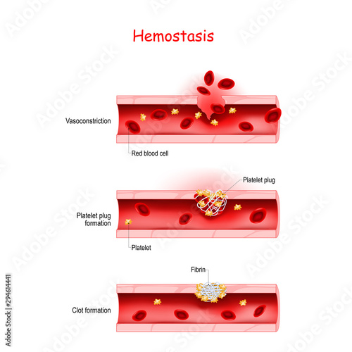 Hemostasis. Basic steps of wound healing process