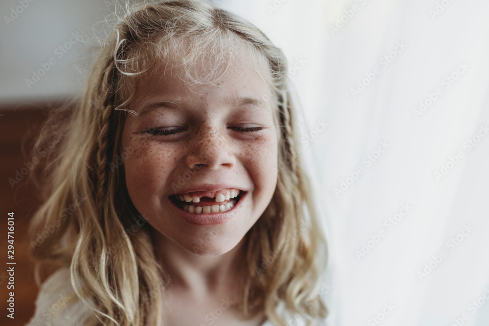 Portrait of young freckled smiling girl missing tooth with eyes closed Portrait of young freckled smiling girl missing tooth with eyes closed