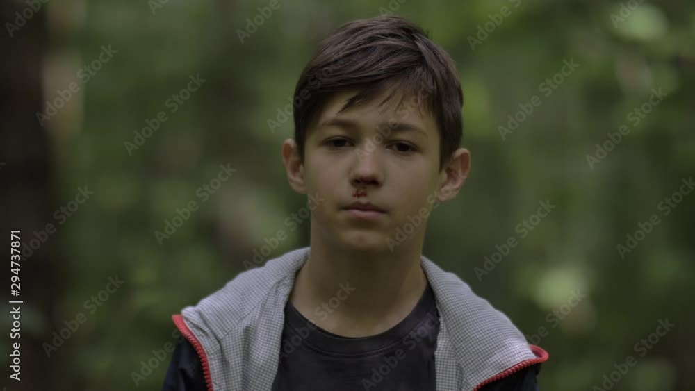 portrait of a sad boy with a broken nose in the forest looking at the camera, nosebleed portrait of a sad boy with a broken nose in the forest looking at the camera, nosebleed