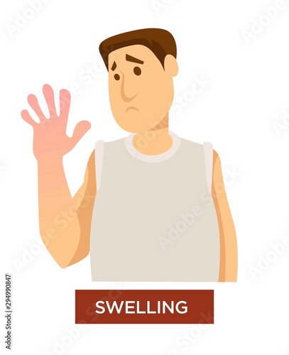 Person experiencing hands swelling and inflammation symptom