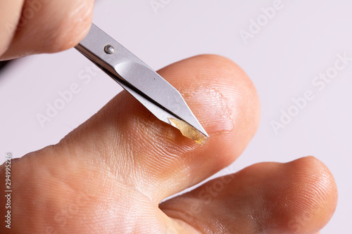 Peeling of foot skin with scissors photo