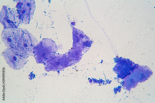 Purple colored parasites under the microscope