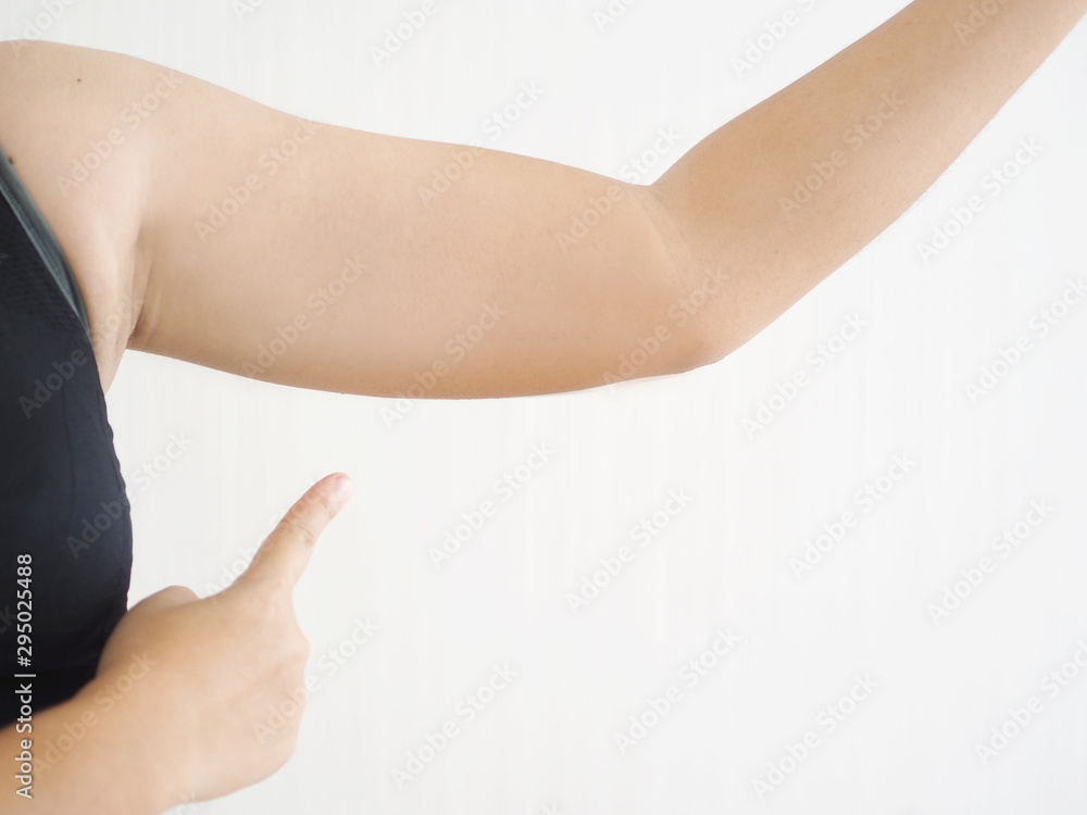 cellulite in asian woman and she pointing her upper arm cause of fatty from weight and loss of collagen use for anti cellulite and body firming gel or cream or beauty product concept. cellulite in asian woman and she pointing her upper arm cause of fatty from weight and loss of collagen use for anti cellulite and body firming gel or cream or beauty product concept.