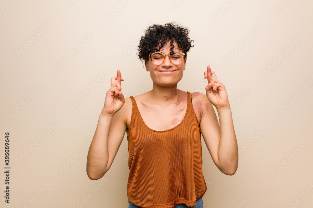 Young african american woman with skin birth mark crossing fingers for having luck Young african american woman with skin birth mark crossing fingers for having luck