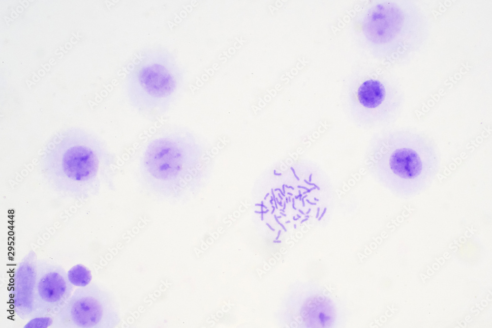 Human chromosomes from blood under microscope view. Stock Photo Adobe