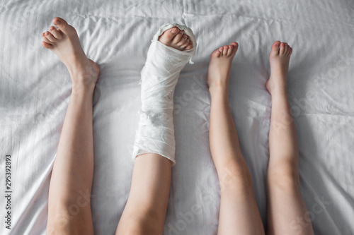 Four legs lie on a white bed. One of them is broken and in white plaster photo