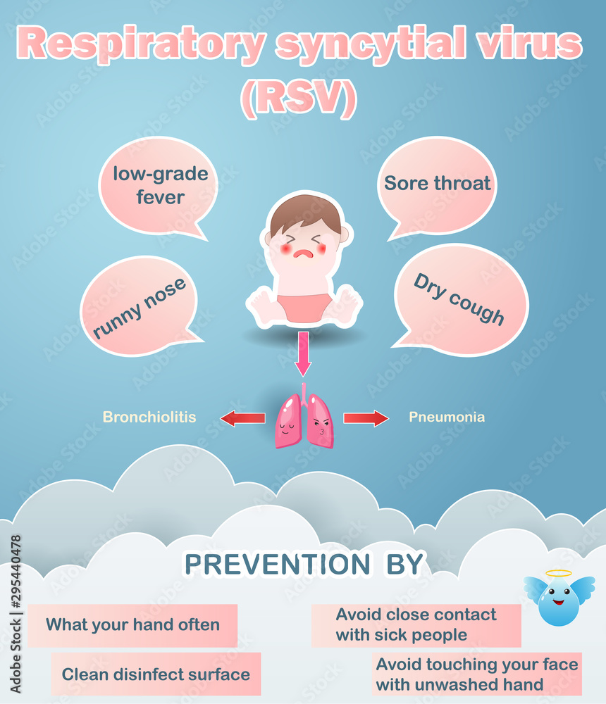 Respiratory syncytial virus outbreaks of bronchiolitis and pneumonia