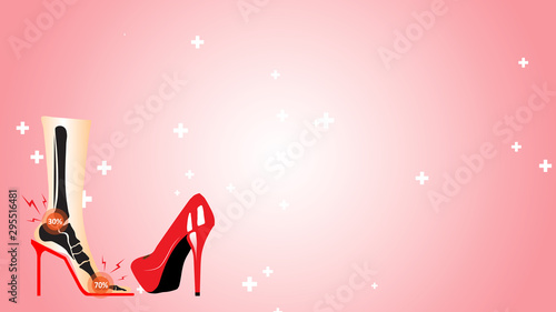 Medical infographic orthopedic .Symptom pain cause from wearing high heels make bone and muscles damage. Vector flat design for radiology orthopedic research hospital, diagnostics. Vector illustration
