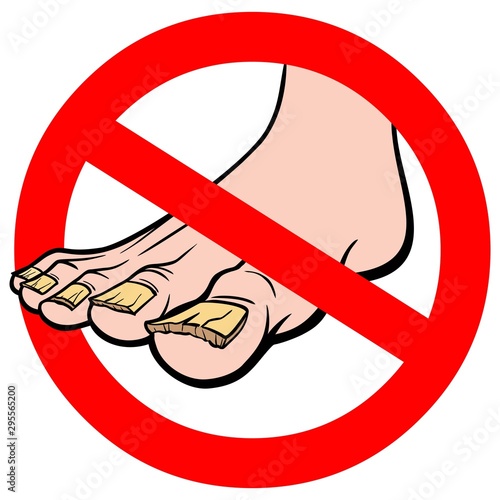 No Nail Fungus - A cartoon illustration of a No Nail Fungus Sign.