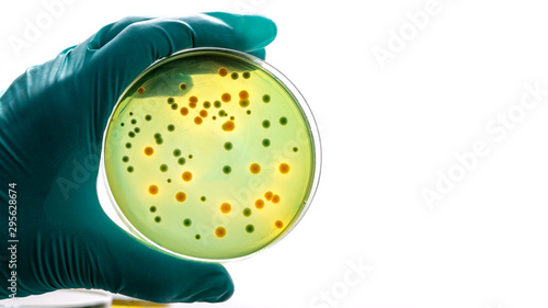 Gloved hand holding a Petri dish Bacteria culture