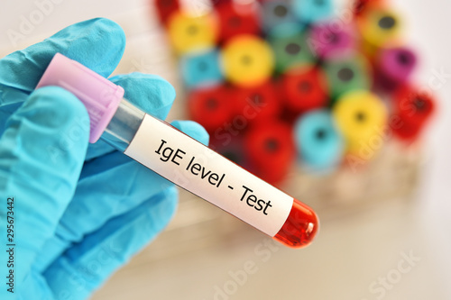 Blood sample tube for Immunoglobulin E or IgE level test, diagnosis for allergy disease photo