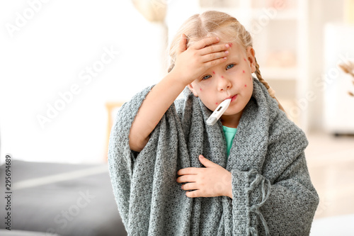 Fotografie Little girl ill with chickenpox at home